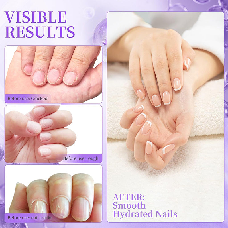 NailSoothe – Närande nagelbandsolja med oljepenna