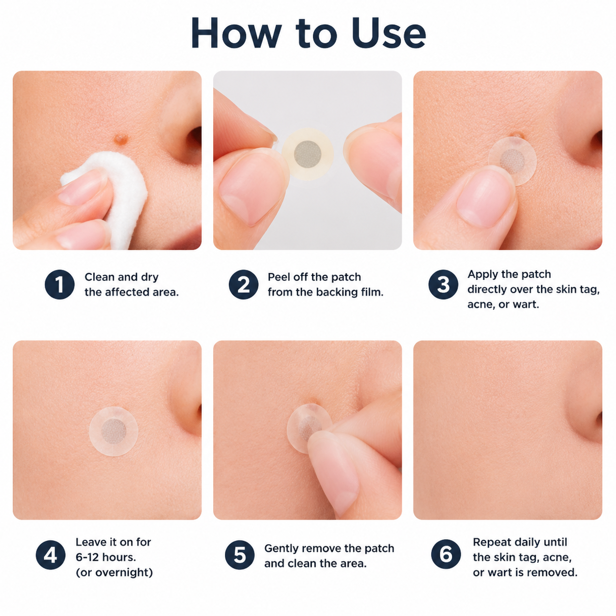 DermaFix – Målinriktad aknebehandlingsplåster