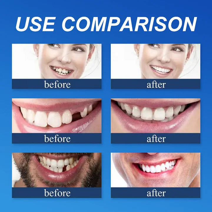 SmileLock – Helprotes med Stark Sugpassform